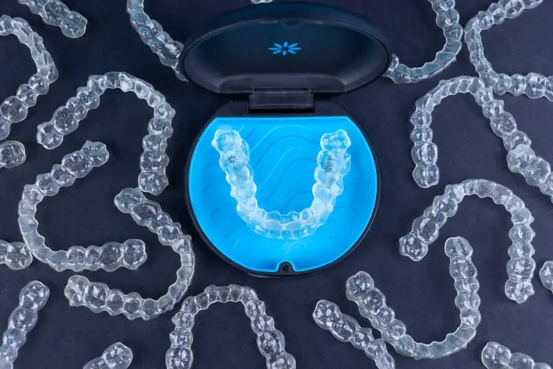 Invisalign kiedy efekty?